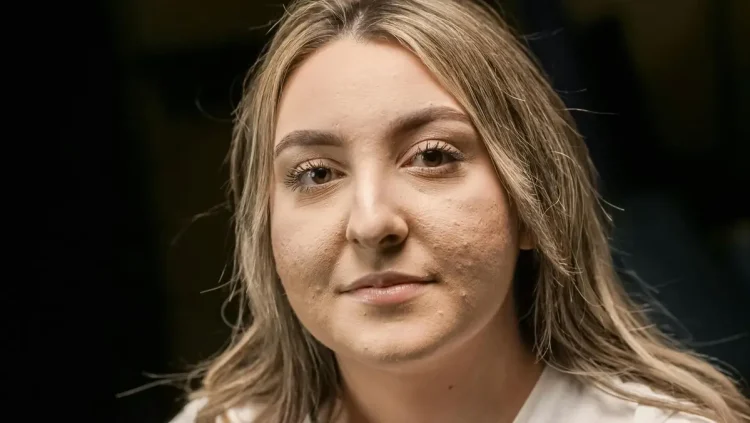 Istekli kozmetički proizvodi: otrov za vašu kožu