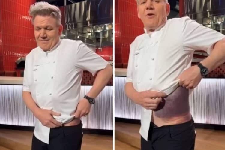 Chef Gordon Ramsay pao s bicikla i zadobio ozljede: ‘Izgledam poput ljubičastog krumpira!’