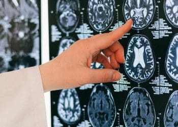 Zbog lošeg zdravstva talijanski grad zabranio stanovnicima ‘teže bolesti’