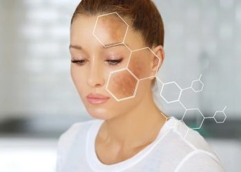 Što uzrokuje melazmu i staračke pjege – kako se zaštititi