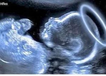 Klanjam Ti se Nerođeni