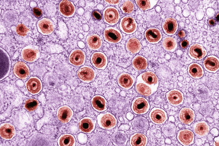 Otkriveni znakovi u krvi prije pojave prvih simptoma Parkinsonove bolesti